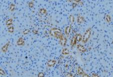 MRPL30 Antibody - 1:100 staining mouse kidney tissue by IHC-P. The sample was formaldehyde fixed and a heat mediated antigen retrieval step in citrate buffer was performed. The sample was then blocked and incubated with the antibody for 1.5 hours at 22°C. An HRP conjugated goat anti-rabbit antibody was used as the secondary.