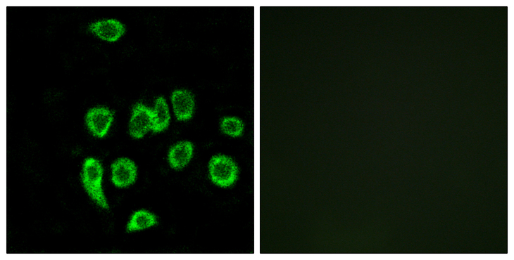 MRPL32 Antibody - Immunofluorescence analysis of A549 cells, using MRPL32 Antibody. The picture on the right is blocked with the synthesized peptide.