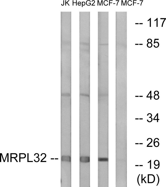 MRPL32 Antibody - Western blot analysis of lysates from MCF-7, HepG2, and Jurkat cells, using MRPL32 Antibody. The lane on the right is blocked with the synthesized peptide.