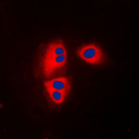 MRPL32 Antibody - Immunofluorescent analysis of MRPL32 staining in HepG2 cells. Formalin-fixed cells were permeabilized with 0.1% Triton X-100 in TBS for 5-10 minutes and blocked with 3% BSA-PBS for 30 minutes at room temperature. Cells were probed with the primary antibody in 3% BSA-PBS and incubated overnight at 4 C in a humidified chamber. Cells were washed with PBST and incubated with a DyLight 594-conjugated secondary antibody (red) in PBS at room temperature in the dark. DAPI was used to stain the cell nuclei (blue).