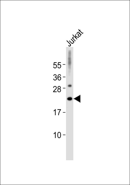 MRPL32 Antibody - Anti-MRPL32 Antibody at 1:1000 dilution + Jurkat whole cell lysates Lysates/proteins at 20 ug per lane. Secondary Goat Anti-Rabbit IgG, (H+L),Peroxidase conjugated at 1/10000 dilution Predicted band size : 21 kDa Blocking/Dilution buffer: 5% NFDM/TBST.