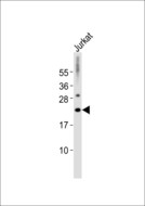 MRPL32 Antibody - Anti-MRPL32 Antibody at 1:1000 dilution + Jurkat whole cell lysates Lysates/proteins at 20 ug per lane. Secondary Goat Anti-Rabbit IgG, (H+L),Peroxidase conjugated at 1/10000 dilution Predicted band size : 21 kDa Blocking/Dilution buffer: 5% NFDM/TBST.