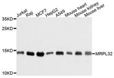 MRPL32 Antibody - Western blot analysis of extracts of various cell lines, using MRPL32 antibody at 1:1000 dilution. The secondary antibody used was an HRP Goat Anti-Rabbit IgG (H+L) at 1:10000 dilution. Lysates were loaded 25ug per lane and 3% nonfat dry milk in TBST was used for blocking. An ECL Kit was used for detection and the exposure time was 10s.