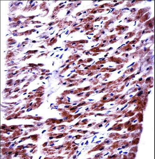 MRPL33 Antibody - RM33 Antibody immunohistochemistry of formalin-fixed and paraffin-embedded human heart tissue followed by peroxidase-conjugated secondary antibody and DAB staining.