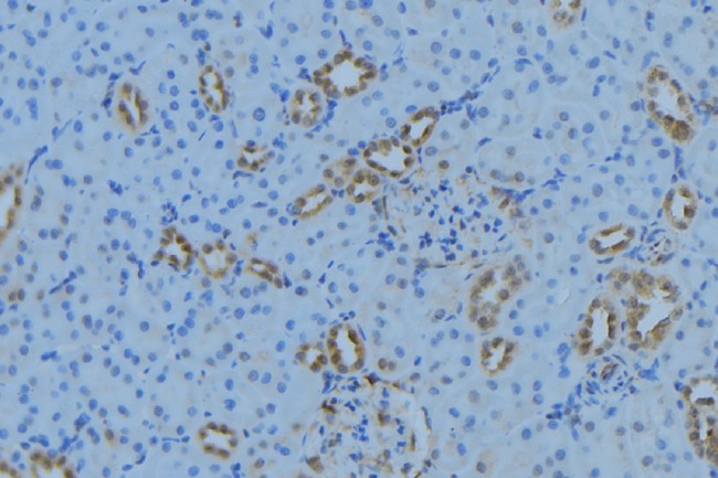 MRPL34 Antibody - 1:100 staining mouse kidney tissue by IHC-P. The sample was formaldehyde fixed and a heat mediated antigen retrieval step in citrate buffer was performed. The sample was then blocked and incubated with the antibody for 1.5 hours at 22°C. An HRP conjugated goat anti-rabbit antibody was used as the secondary.