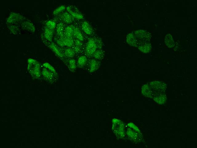 MRPL34 Antibody - Immunofluorescence staining of MRPL34 in HEK293 cells. Cells were fixed with 4% PFA, permeabilzed with 0.1% Triton X-100 in PBS, blocked with 10% serum, and incubated with rabbit anti-Human MRPL34 polyclonal antibody (dilution ratio 1:200) at 4°C overnight. Then cells were stained with the Alexa Fluor 488-conjugated Goat Anti-rabbit IgG secondary antibody (green). Positive staining was localized to Nucleus.