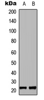 MRPL35 Antibody - Western blot analysis of MRPL35 expression in COLO205 (A); HEK293T (B) whole cell lysates.