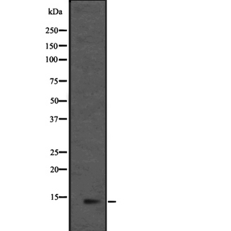 MRPL36 Antibody - Western blot analysis of L36mt expression in HEK293 cells. The lane on the left is treated with the antigen-specific peptide.