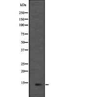 MRPL36 Antibody - Western blot analysis of L36mt expression in HEK293 cells. The lane on the left is treated with the antigen-specific peptide.