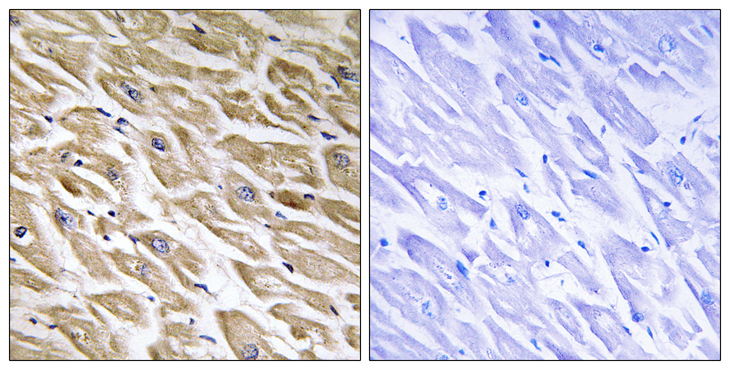 MRPL39 Antibody - Immunohistochemistry analysis of paraffin-embedded human heart tissue, using MRPL39 Antibody. The picture on the right is blocked with the synthesized peptide.