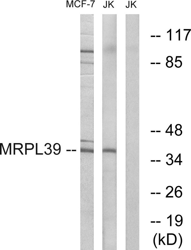 MRPL39 Antibody - Western blot analysis of lysates from Jurkat and MCF-7 cells, using MRPL39 Antibody. The lane on the right is blocked with the synthesized peptide.