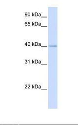 MRPL39 Antibody - Fetal heart lysate. Antibody concentration: 1.0 ug/ml. Gel concentration: 12%.  This image was taken for the unconjugated form of this product. Other forms have not been tested.