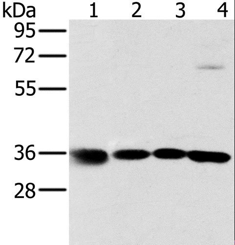 MRPL39 Antibody - Western blot analysis of 293T, K562, 231 and HeLa cell, using MRPL39 Polyclonal Antibody at dilution of 1:600.