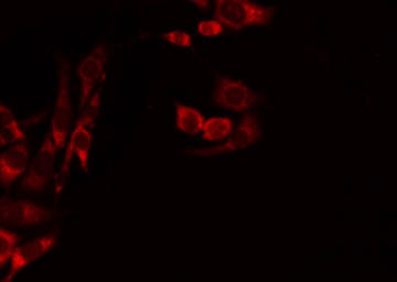 MRPL39 Antibody - Staining HeLa cells by IF/ICC. The samples were fixed with PFA and permeabilized in 0.1% Triton X-100, then blocked in 10% serum for 45 min at 25°C. The primary antibody was diluted at 1:200 and incubated with the sample for 1 hour at 37°C. An Alexa Fluor 594 conjugated goat anti-rabbit IgG (H+L) Ab, diluted at 1/600, was used as the secondary antibody.