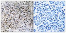MRPL40 Antibody - Immunohistochemistry analysis of paraffin-embedded human pancreas tissue, using MRPL40 Antibody. The picture on the right is blocked with the synthesized peptide.