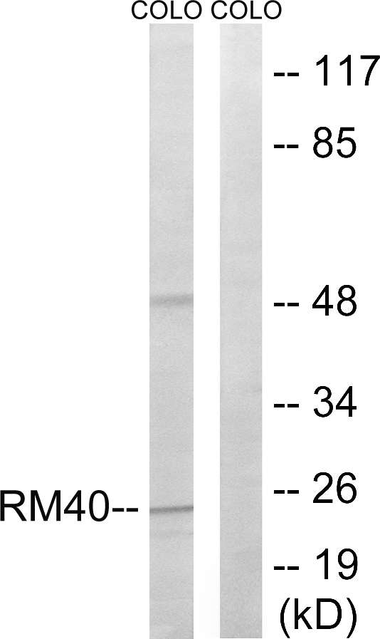 MRPL40 Antibody - Western blot analysis of lysates from COLO cells, using MRPL40 Antibody. The lane on the right is blocked with the synthesized peptide.
