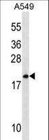 MRPL40 Antibody - MRPL40 Antibody western blot of A549 cell line lysates (35 ug/lane). The MRPL40 antibody detected the MRPL40 protein (arrow).