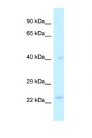 MRPL40 Antibody - MRPL40 antibody Western blot of Fetal Liver lysate. Antibody concentration 1 ug/ml.  This image was taken for the unconjugated form of this product. Other forms have not been tested.