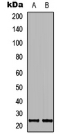 MRPL40 Antibody - Western blot analysis of MRPL40 expression in SHSY5Y (A); NIH3T3 (B) whole cell lysates.
