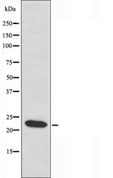 MRPL40 Antibody - Western blot analysis of extracts of COLO cells using MRPL40 antibody.