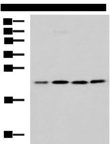 MRPL40 Antibody - Western blot analysis of K562 A172 Jurkat LOVO cell lysates  using MRPL40 Polyclonal Antibody at dilution of 1:1000