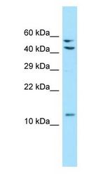 MRPL41 / PIG3 / BMRP Antibody - MRPL41 / PIG3 / BMRP antibody Western Blot of 293T.  This image was taken for the unconjugated form of this product. Other forms have not been tested.