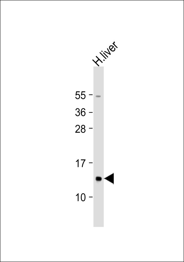 MRPL41 / PIG3 / BMRP Antibody - Anti-MRPL41 Antibody at 1:1000 dilution + human liver lysate Lysates/proteins at 20 ug per lane. Secondary Goat Anti-Rabbit IgG, (H+L), Peroxidase conjugated at 1:10000 dilution. Predicted band size: 15 kDa. Blocking/Dilution buffer: 5% NFDM/TBST.