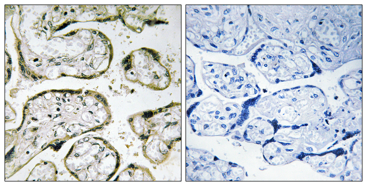 MRPL42 / MRPS32 Antibody - Immunohistochemistry analysis of paraffin-embedded human placenta, using MRPS32 Antibody. The picture on the right is blocked with the synthesized peptide.