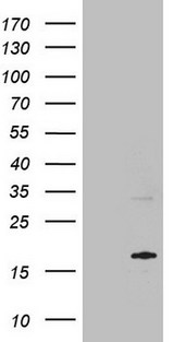 MRPL42 / MRPS32 Antibody - HEK293T cells were transfected with the pCMV6-ENTRY control. (Left lane) or pCMV6-ENTRY MRPL42. (Right lane) cDNA for 48 hrs and lysed. Equivalent amounts of cell lysates. (5 ug per lane) were separated by SDS-PAGE and immunoblotted with anti-MRPL42. (1:2000)