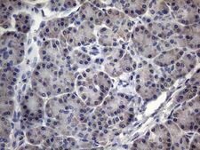 MRPL42 / MRPS32 Antibody - Immunohistochemical staining of paraffin-embedded Human pancreas tissue within the normal limits using anti-MRPL42 mouse monoclonal antibody. (Heat-induced epitope retrieval by 1mM EDTA in 10mM Tris buffer. (pH8.5) at 120°C for 3 min. (1:150)