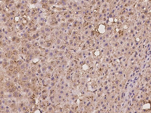 MRPL42 / MRPS32 Antibody - Immunochemical staining of human MRPL42 in human liver with rabbit polyclonal antibody at 1:100 dilution, formalin-fixed paraffin embedded sections.