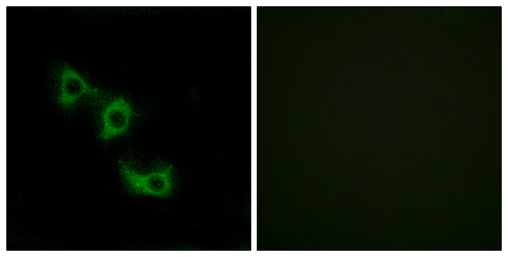 MRPL44 Antibody - Immunofluorescence analysis of HUVEC cells, using MRPL44 Antibody. The picture on the right is blocked with the synthesized peptide.