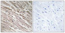 MRPL44 Antibody - Immunohistochemistry analysis of paraffin-embedded human heart tissue, using MRPL44 Antibody. The picture on the right is blocked with the synthesized peptide.