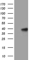MRPL44 Antibody - HEK293T cells were transfected with the pCMV6-ENTRY control. (Left lane) or pCMV6-ENTRY MRPL44. (Right lane) cDNA for 48 hrs and lysed. Equivalent amounts of cell lysates. (5 ug per lane) were separated by SDS-PAGE and immunoblotted with anti-MRPL44. (1:500)