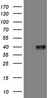 MRPL44 Antibody - HEK293T cells were transfected with the pCMV6-ENTRY control. (Left lane) or pCMV6-ENTRY MRPL44. (Right lane) cDNA for 48 hrs and lysed. Equivalent amounts of cell lysates. (5 ug per lane) were separated by SDS-PAGE and immunoblotted with anti-MRPL44. (1:2000)