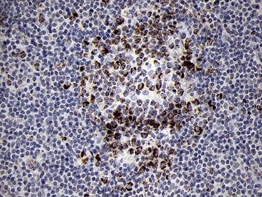 MRPL44 Antibody - Immunohistochemical staining of paraffin-embedded Human tonsil within the normal limits using anti-MRPL44 mouse monoclonal antibody. (Heat-induced epitope retrieval by 1mM EDTA in 10mM Tris buffer. (pH8.5) at 120°C for 3 min. (1:500)