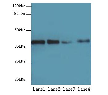 MRPL44 Antibody - Western blot. All lanes: MRPL44 antibody at 6 ug/ml. Lane 1: HeLa whole cell lysate. Lane 2: Jurkat whole cell lysate. Lane 3: HepG-2 whole cell lysate. Lane 4: K562 whole cell lysate. Secondary Goat polyclonal to Rabbit IgG at 1:10000 dilution. Predicted band size: 38 kDa. Observed band size: 38 kDa.