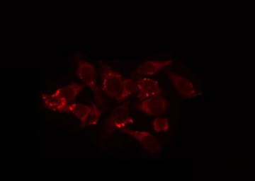 MRPL44 Antibody - Staining COS7 cells by IF/ICC. The samples were fixed with PFA and permeabilized in 0.1% Triton X-100, then blocked in 10% serum for 45 min at 25°C. The primary antibody was diluted at 1:200 and incubated with the sample for 1 hour at 37°C. An Alexa Fluor 594 conjugated goat anti-rabbit IgG (H+L) Ab, diluted at 1/600, was used as the secondary antibody.