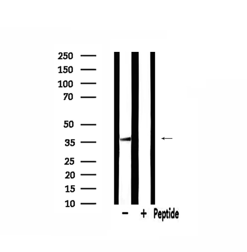 MRPL44 Antibody - Western blot analysis of extracts of 293 cells using MRPL44 antibody.
