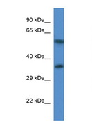 MRPL45 Antibody - MRPL45 antibody Western blot of Fetal Heart lysate. Antibody concentration 1 ug/ml.  This image was taken for the unconjugated form of this product. Other forms have not been tested.