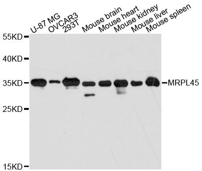 MRPL45 Antibody - Western blot analysis of extracts of various cell lines, using MRPL45 antibody at 1:3000 dilution. The secondary antibody used was an HRP Goat Anti-Rabbit IgG (H+L) at 1:10000 dilution. Lysates were loaded 25ug per lane and 3% nonfat dry milk in TBST was used for blocking. An ECL Kit was used for detection and the exposure time was 60s.