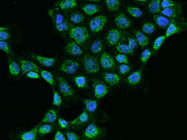 MRPL45 Antibody - Immunofluorescence staining of MRPL45 in A431 cells. Cells were fixed with 4% PFA, permeabilzed with 0.1% Triton X-100 in PBS, blocked with 10% serum, and incubated with rabbit anti-Human MRPL45 polyclonal antibody (dilution ratio 1:200) at 4°C overnight. Then cells were stained with the Alexa Fluor 488-conjugated Goat Anti-rabbit IgG secondary antibody (green) and counterstained with DAPI (blue). Positive staining was localized to Cytoplasm.
