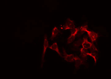 MRPL46 Antibody - Staining HeLa cells by IF/ICC. The samples were fixed with PFA and permeabilized in 0.1% Triton X-100, then blocked in 10% serum for 45 min at 25°C. The primary antibody was diluted at 1:200 and incubated with the sample for 1 hour at 37°C. An Alexa Fluor 594 conjugated goat anti-rabbit IgG (H+L) Ab, diluted at 1/600, was used as the secondary antibody.