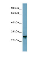 MRPL48 Antibody - MRPL48 antibody Western blot of Jurkat lysate. This image was taken for the unconjugated form of this product. Other forms have not been tested.