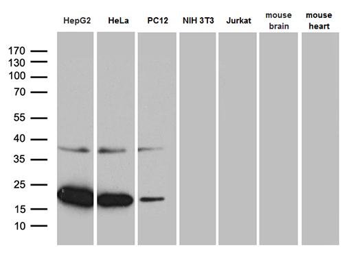 MRPL48 Antibody - Western blot analysis of extracts. (35ug) from 5 different cell lines and 2 different tissue lysates by using anti-MRPL48 monoclonal antibody. (1:500)