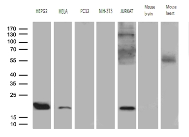 MRPL48 Antibody - Western blot analysis of extracts. (35ug) from 5 different cell lines and 2 different tissue lysates by using anti-MRPL48 monoclonal antibody. (1:500)