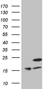 MRPL48 Antibody - HEK293T cells were transfected with the pCMV6-ENTRY control. (Left lane) or pCMV6-ENTRY MRPL48. (Right lane) cDNA for 48 hrs and lysed