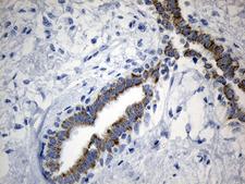 MRPL48 Antibody - Immunohistochemical staining of paraffin-embedded Human breast tissue within the normal limits using anti-MRPL48 mouse monoclonal antibody. (Heat-induced epitope retrieval by 1mM EDTA in 10mM Tris buffer. (pH8.5) at 120°C for 3 min. (1:150)