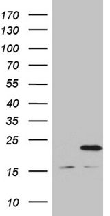 MRPL48 Antibody - HEK293T cells were transfected with the pCMV6-ENTRY control. (Left lane) or pCMV6-ENTRY MRPL48. (Right lane) cDNA for 48 hrs and lysed. Equivalent amounts of cell lysates. (5 ug per lane) were separated by SDS-PAGE and immunoblotted with anti-MRPL48. (1:2000)