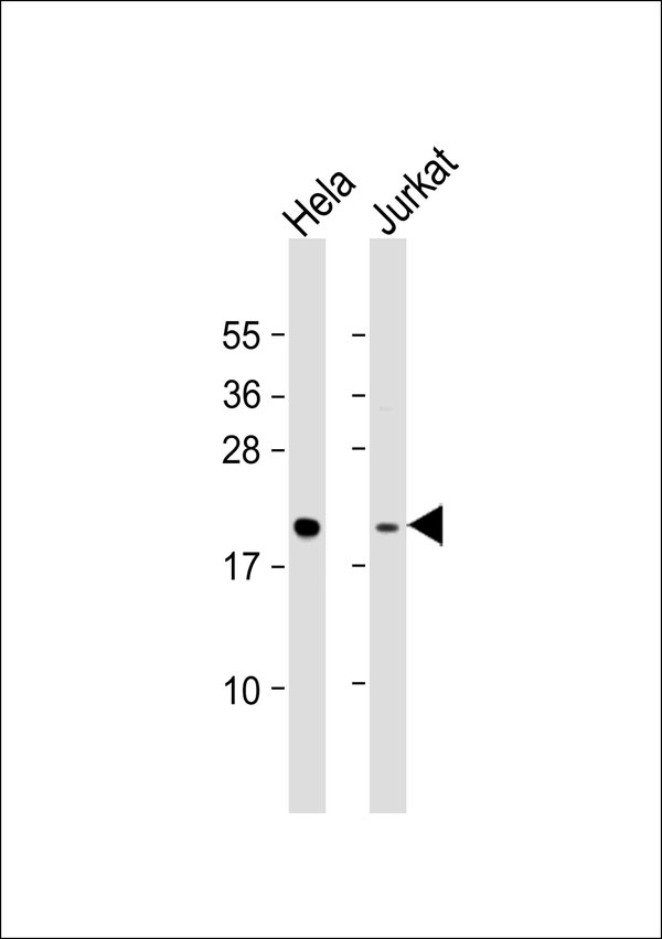 MRPL48 Antibody - All lanes: Anti-MRPL48 Antibody at 1:1000 dilution. Lane 1: HeLa whole cell lysate. Lane 2: Jurkat whole cell lysate Lysates/proteins at 20 ug per lane. Secondary Goat Anti-Rabbit IgG, (H+L), Peroxidase conjugated at 1:10000 dilution. Predicted band size: 24 kDa. Blocking/Dilution buffer: 5% NFDM/TBST.